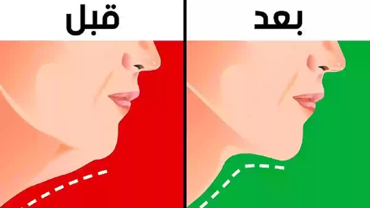 مشهورة التيك توك تشرح أهم طريقتين للتخلص من اللغد بشكل نهائي